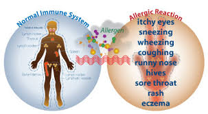 Reações Alérgicas